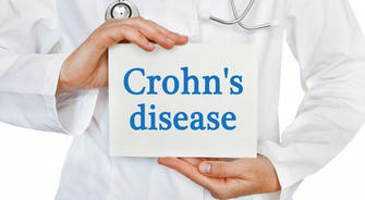 Preventing Crohn's Disease: Key Guidelines For a More Comfortable Life